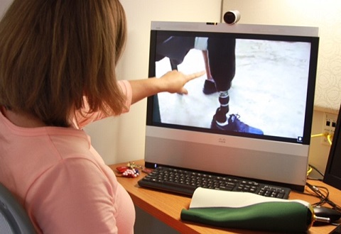 Virtual care point of view as a clinician views a Veteran's prosthetic leg